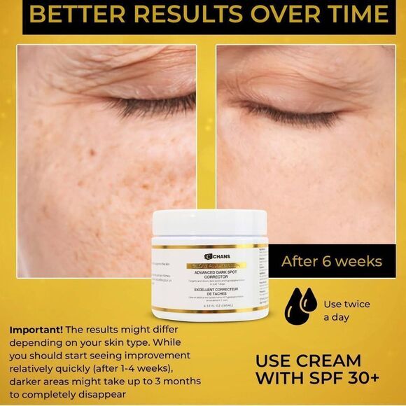 NIB CCHANS ADVANCED DARK SPOTS CORRECTOR FACE/BODY MINIMIZE SCARS/SKIN DAMAGE - Picture 4 of 14